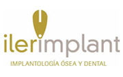 Ilerimplant
